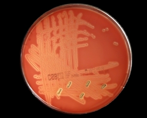 Streptococcus Agalactiae Under Microscope, Group B Streptococcus Or GBS ...